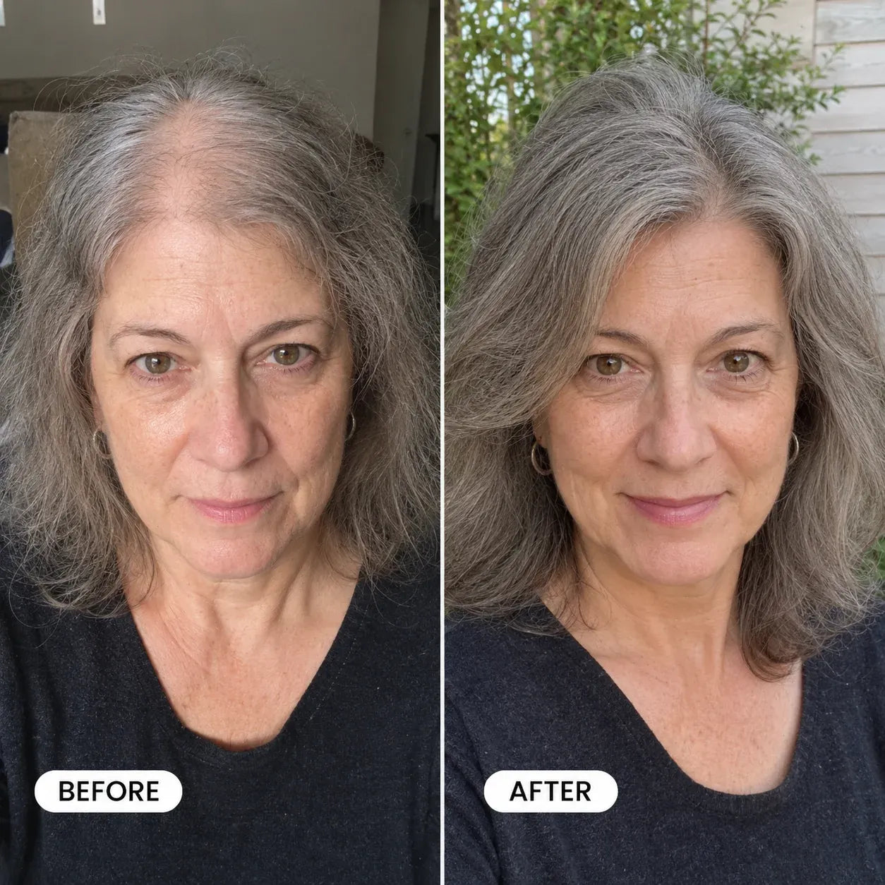 Velutín Repair Spray — Eliminates Thinning Hair
