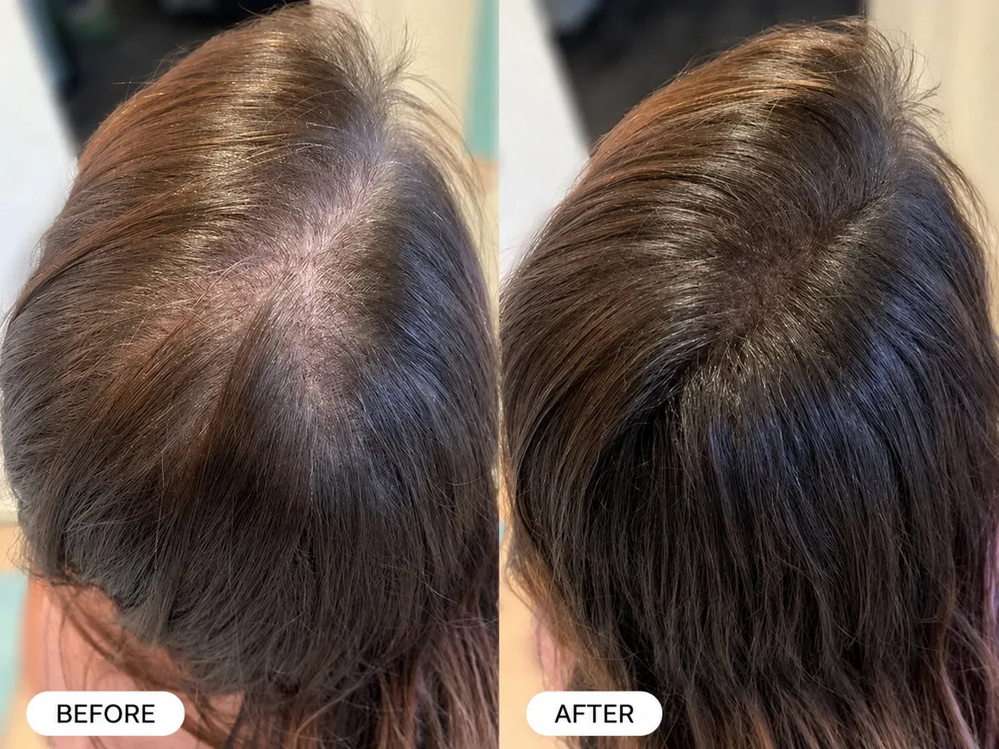 Velutín Repair Spray — Eliminates Thinning Hair